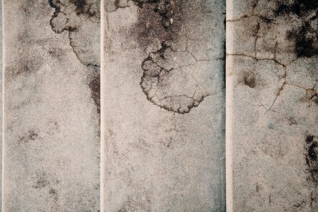 Một sinh viên nghi bị liệt não sau khi bán thận