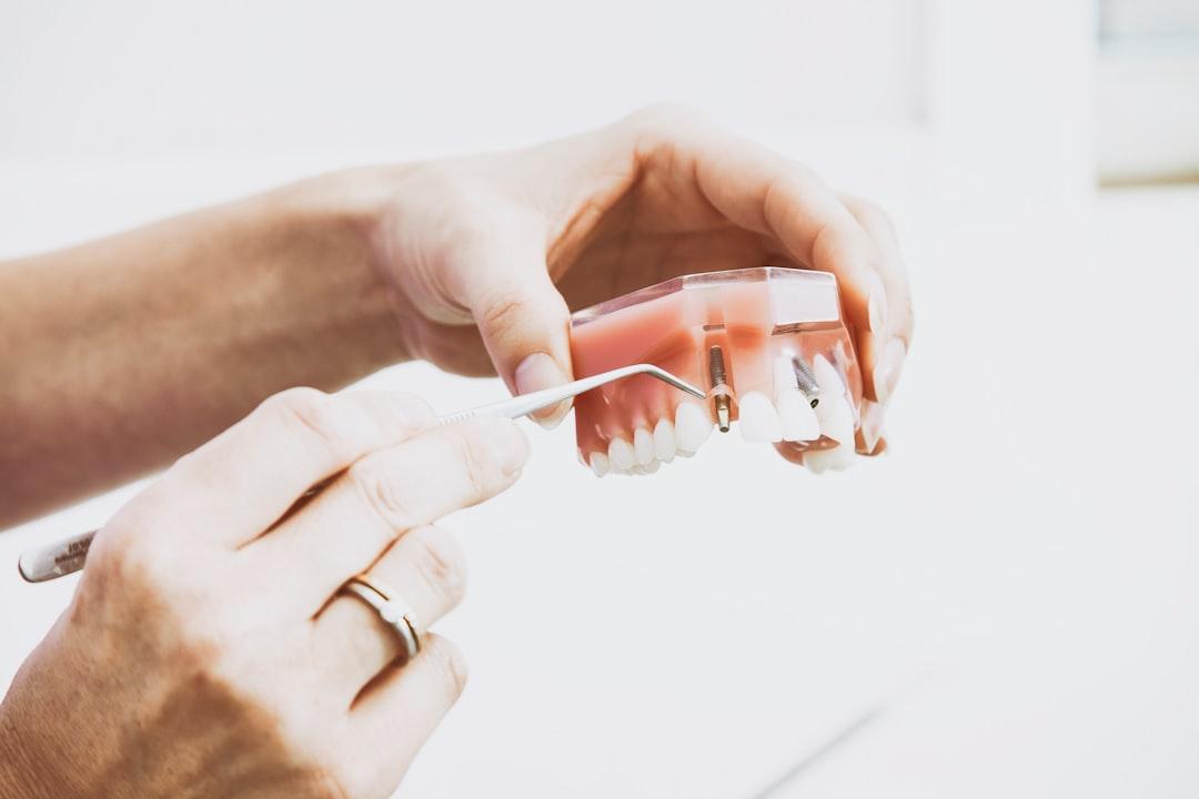 Person wearing silver-colored ring while holding denture from Peter Kasprzyk on Unsplash Rượu vang trắng gây ố răng