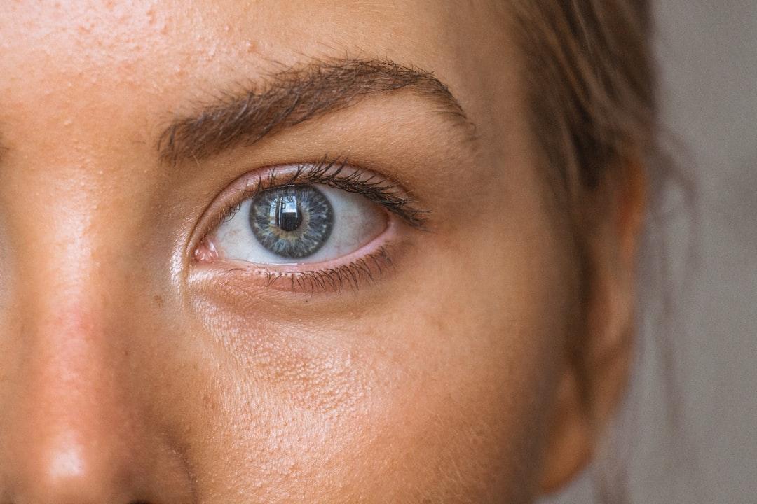 Close-up photo of persons eye from Amanda Dalbjörn on Unsplash Nấm bẹn, không nên bạ gì bôi nấy