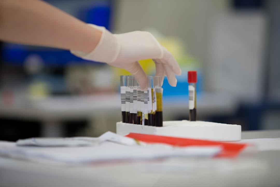 A person in white gloves is putting a bottle of wine in a test tube from Adrian Sulyok on Unsplash Năm lý do vì sao bạn cần ngủ nhiều hơn
