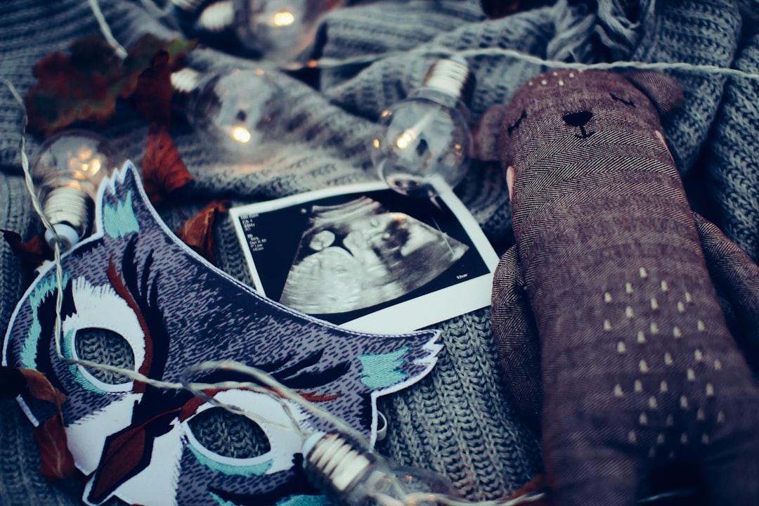 Ultrasound photo surrounded by string lights from Daiga Ellaby on Unsplash